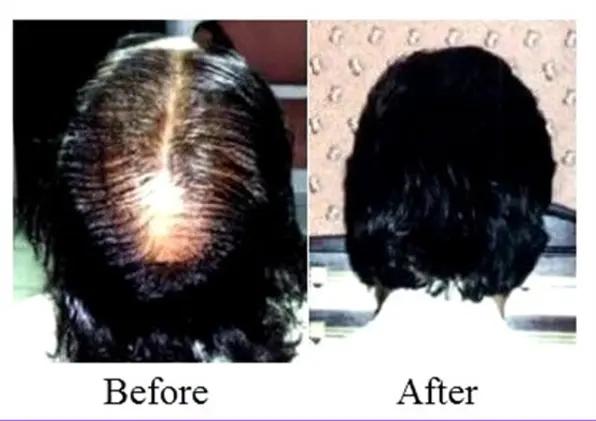 A before and after picture of a woman 's hair.